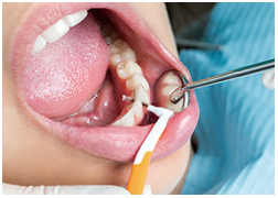 定期歯科検診の様子